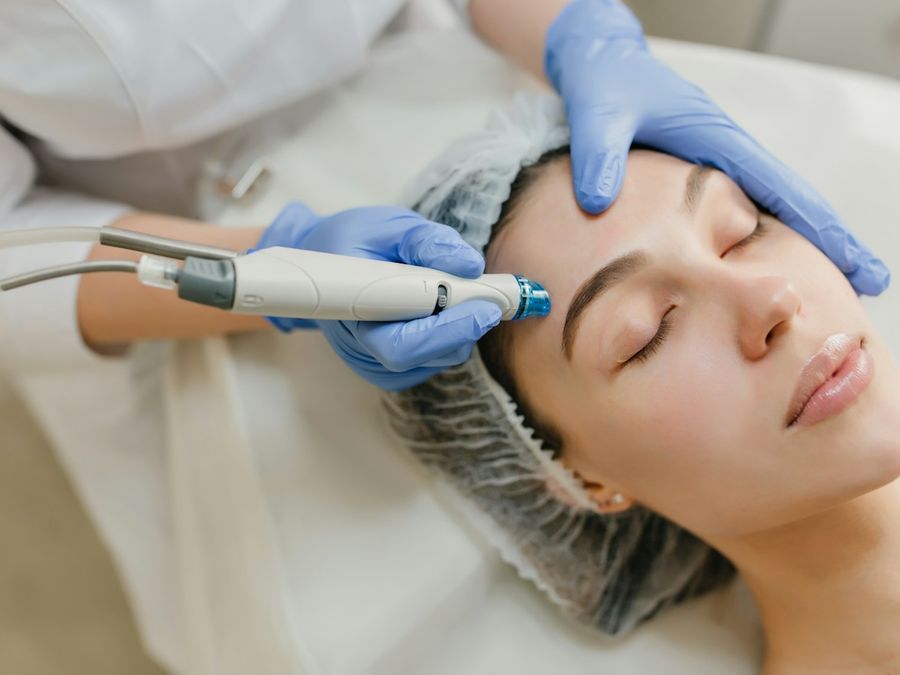 Tratamiento de bioestimulación facial