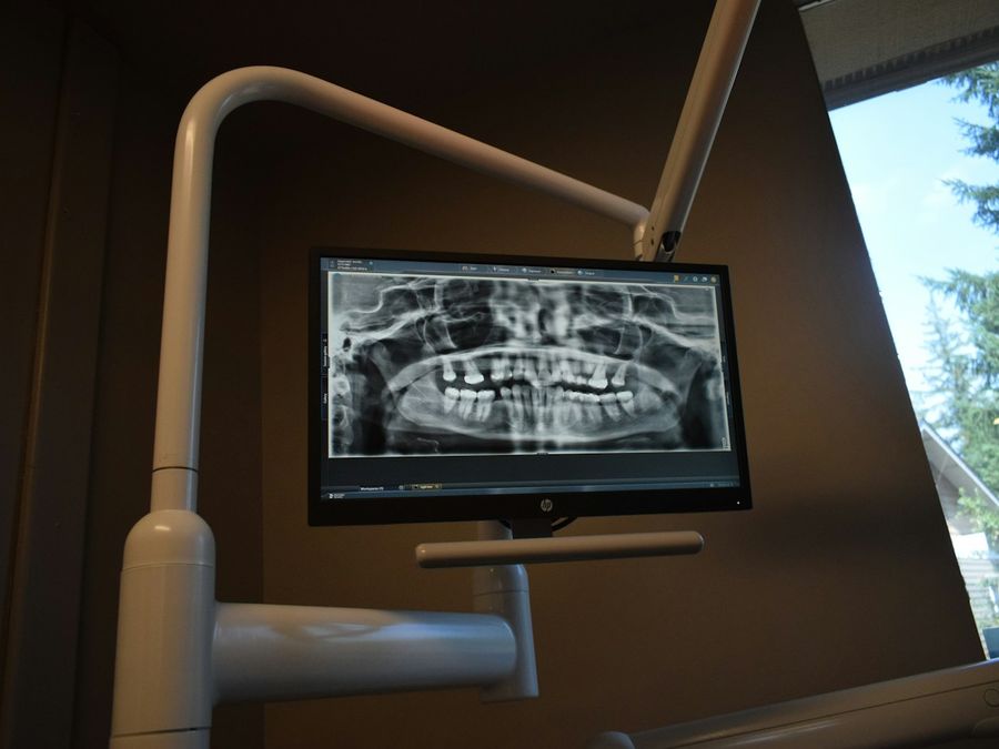 Radiografía dental panorámica en el monitor de un box