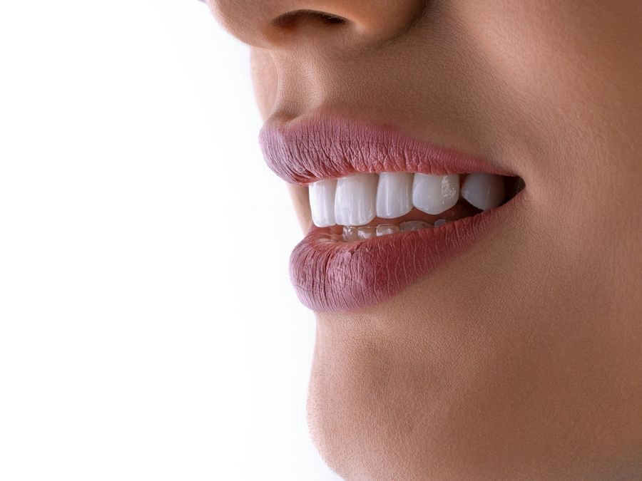 Sonrisa con dientes blancos y armónicos