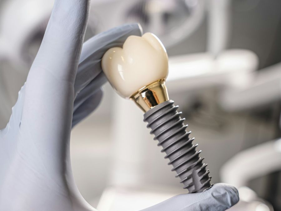 Implante dental con corona sostenido por una mano con guante