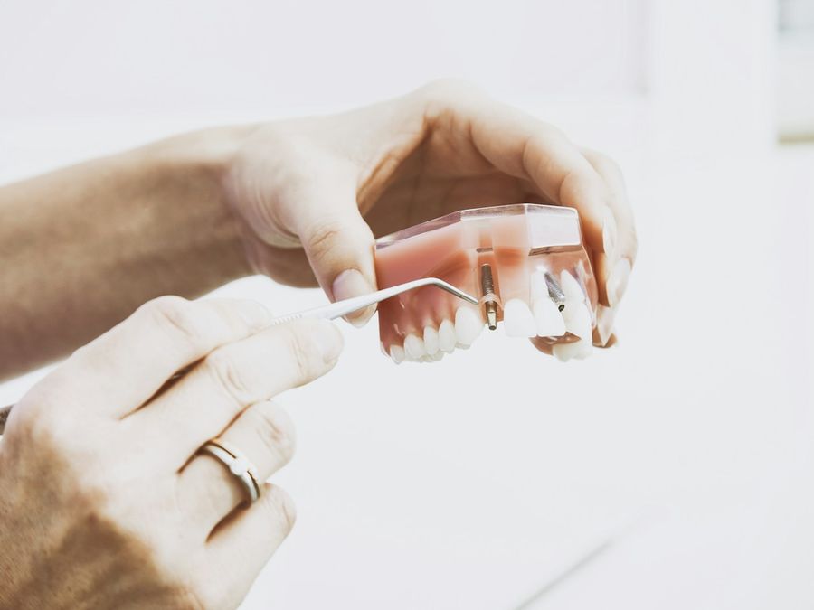 Modelo de prótesis dental en manos de una profesional